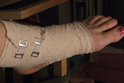 Bandaged ankle
